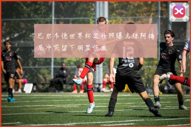 巴尔韦德世界杯定妆照曝光琼阿梅尼冲突留下明显伤痕